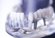 Operating profit declines at Denplan