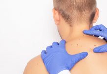 TriSpan backed skin acquires London-based mole clinic