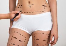 USA, Brazil, Japan, Italy and Mexico lead for cosmetic surgery growth