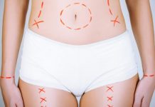 ISAPS highlights growth of labiaplasty