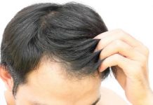 Pakistan seek to promote hair and organ transplants