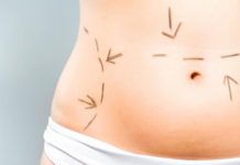 Cosmetic surgery drives Armenian medical tourism