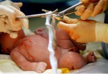 Arrests in Japan for unlicensed cord blood therapies