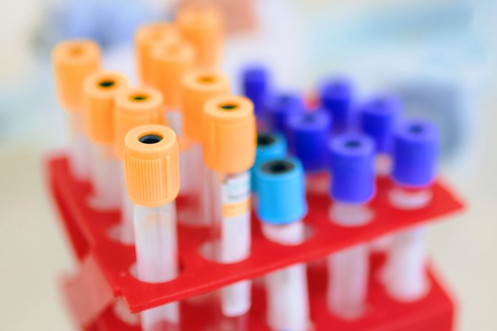 Test tubes in hospital