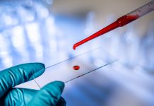 Report calls for prioritisation of in vitro diagnostics in NHS planning