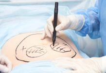 Ireland warns of cosmetic surgery abroad