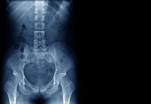 Simplyhealth pilots new scanning service