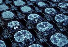 Harnessing growth in radiology services