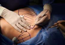 Seasonal trends in cosmetic procedures