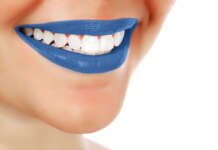 Private Equity is transforming European smiles