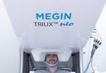 MYndspan partnership to offer direct-to-consumer brain scans