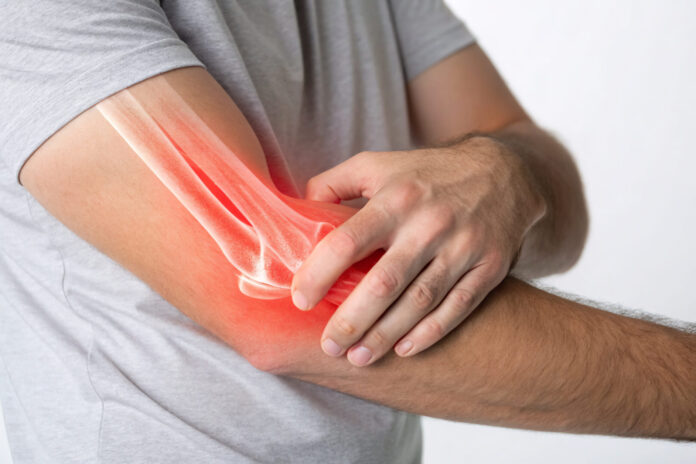 Elbow Pain Illustration with X-Ray Highlighting Tendonitis – Medical Concept Image for Injury and Joint Issues