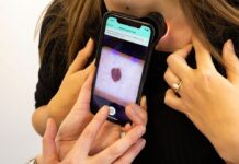 NICE backs AI skin cancer tool for NHS use