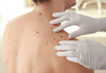 Skin cancer care in the UK private acute sector