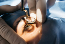 UK ophthalmology: why the cataract market is the one to watch