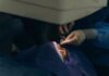 Cataract surgery drives record self-pay levels in Q1 2026