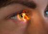 IHPN warns of postcode lottery in NHS eyecare provision